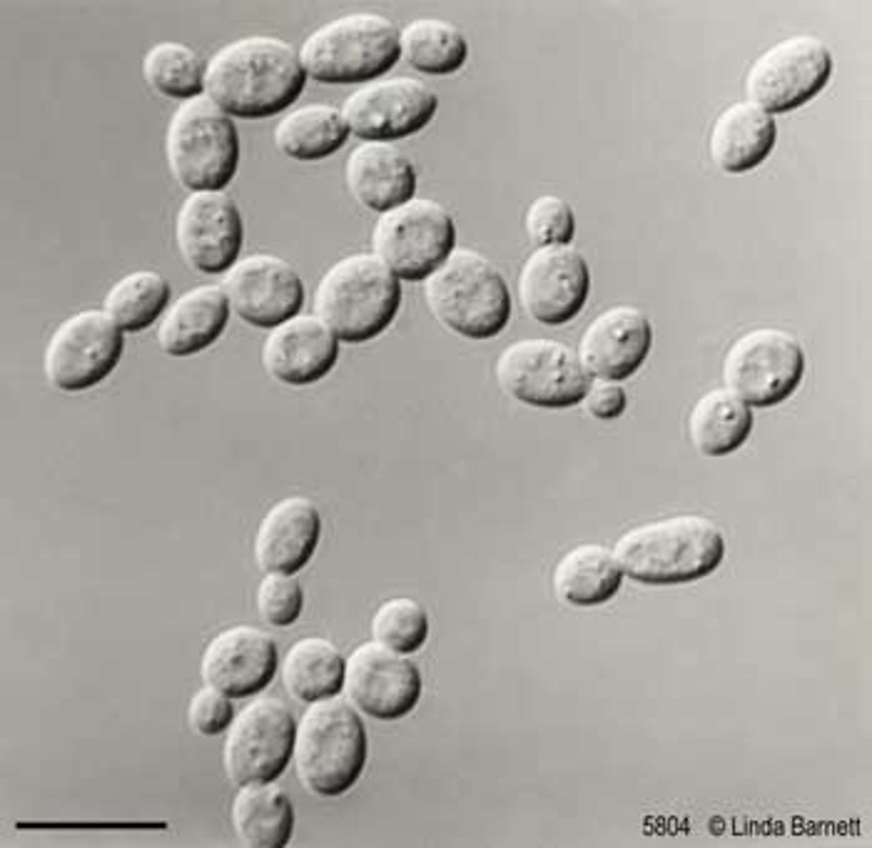 <p>Globose or oval blastoconidia</p><p>Rare pseudohyphae</p>