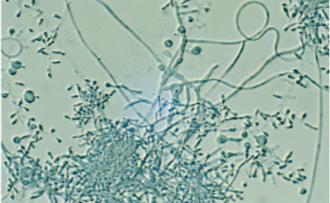 <p><span style="background-color: transparent;">clustered microconidia and spiral hyphae ; </span><span>white velvet, fluffy (colonies)</span></p>