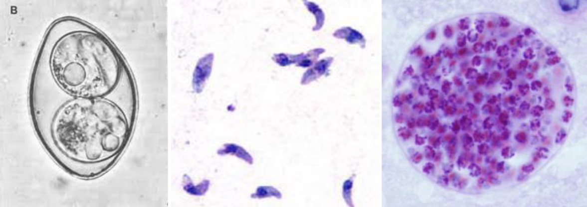 <p>toxoplasma gondii</p>