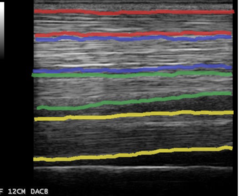 <p>This is an longitudinal ultrasound image, what are the different structures?</p>