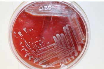 <p><span style="background-color: transparent;">Properly streaked plate with isolated colonies in the 4<sup>th</sup> quadrant</span></p>