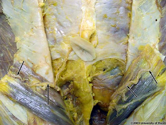 <p>what artery is being indicated to in the image</p>