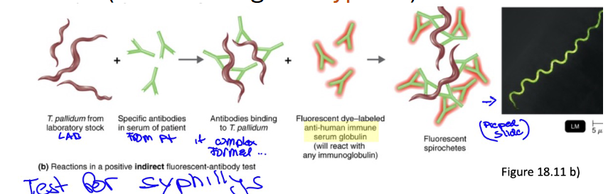 <p>• Looking for a <u>specific antibody</u> in the patient’s serum (Ig M)</p><p>• Fluorescent dye-labeled <u>Anti-Human Antibody</u> is added and will react with any human antibody in serum if the result is positive</p><p>• <u>Antibodies that bind Only binds to human Antibodies</u></p><p>• Application/usage: To determine if <u>T. Pallidum</u> from patient’s blood sample is producing antibodies (<u>causative agent: Syphilis</u>)</p>