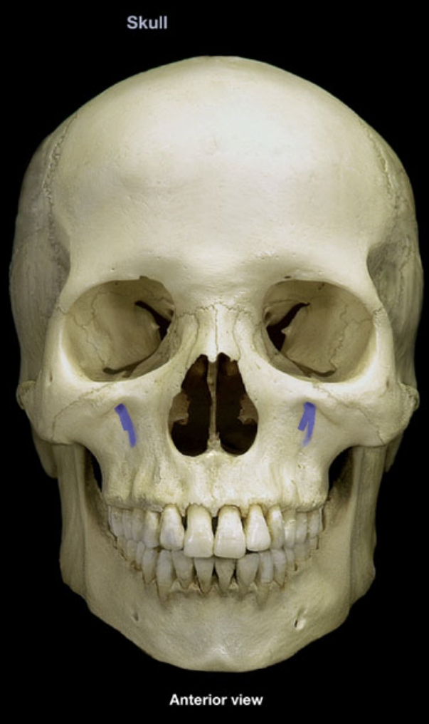 term image