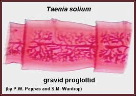 <p>Taenia solium proglottid</p>