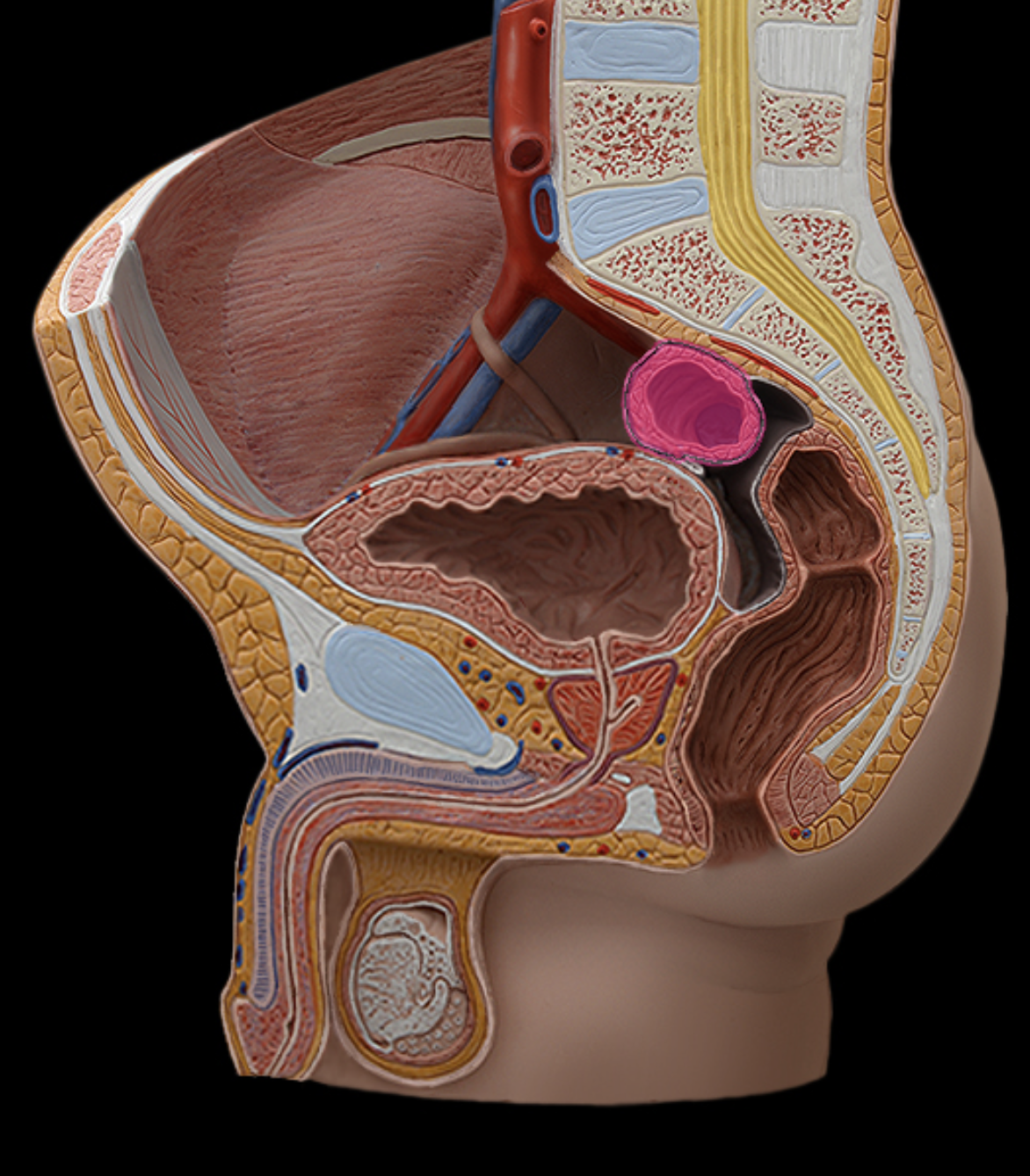 <p>sigmoid colon</p>