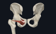 <p>What’s this muscle?</p>