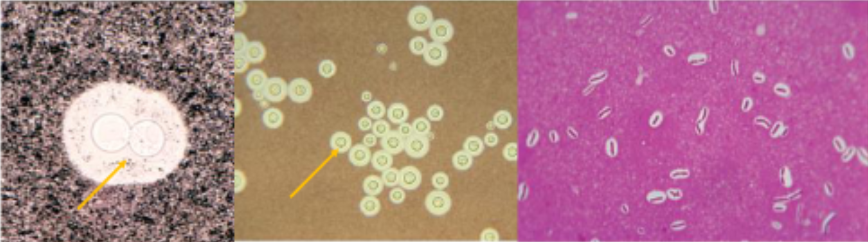 <p>capsule: gel like polysaccharide layer surrounding cell</p><ul><li><p>stains poorly, negative stain often used, use acidic dyes</p></li><li><p>allows capsule to stand out around organism </p></li></ul><p></p>