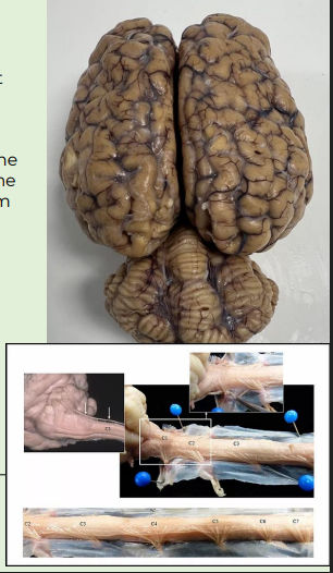 <p>Most spinal reflexes can be overridden at least temporarily by higher brain centers</p><p></p><p>Impulses may be sent down descending pathways to the efferent neurons supplying the involved muscles to override the input from the receptors, actually preventing the muscle from contracting despite a harmful stimulus</p>