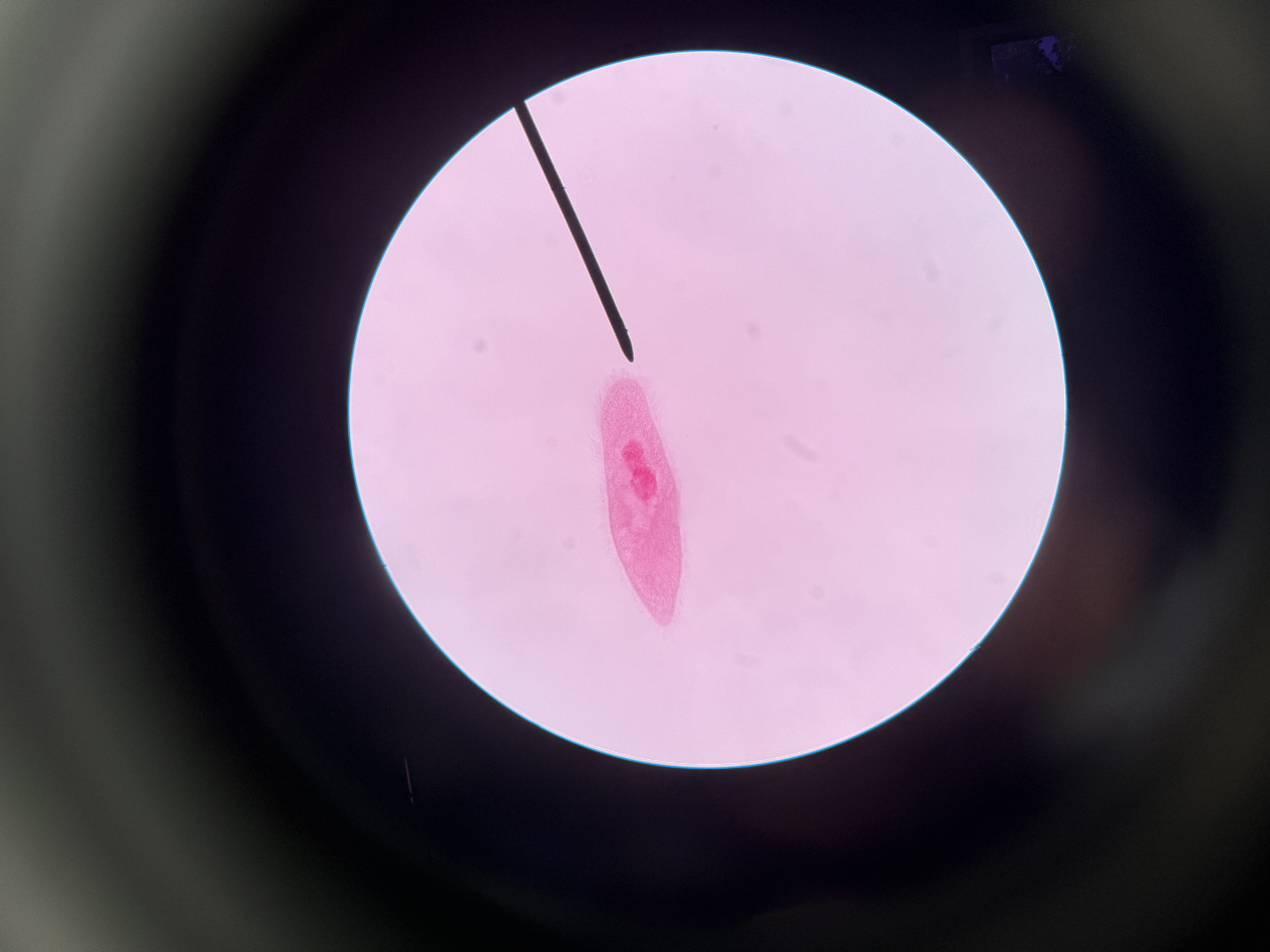<ol><li><p>What is this?</p></li><li><p>What phylum?</p></li><li><p>Spore Location?</p></li><li><p>Autotrophic or heterotrophic?</p></li><li><p>Unicellular or multicellular?</p></li><li><p>What supergroup?</p></li><li><p>What do they use to move and can you identify it?</p></li></ol><p></p>