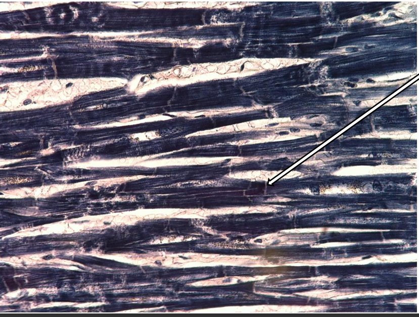 <p>what part of the muscle tissue is this? </p>