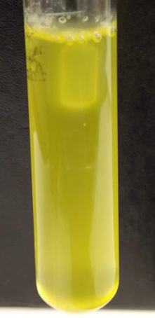 <p>Question options:</p><p>This bacteria ferments the carbohydrate lactose (included in the broth) and produces Carbon Dioxide gas, but does not produce acid.</p><p>This bacteria ferments the carbohydrate lactose (included in the broth) and produces lactic acid and Carbon Dioxide gas.</p><p>This bacteria ferments the carbohydrate lactose (included in the broth) and produces lactic acid and Oxygen gas.</p><p>This bacteria does not ferment the carbohydrate lactose (included in the broth.)</p><p>This bacteria ferments the carbohydrate lactose (included in the broth) and produces lactic acid but does not produce gas.</p>