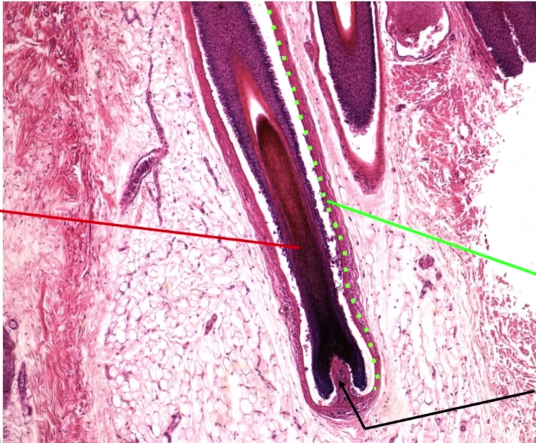 <p>Identify the black structure</p>