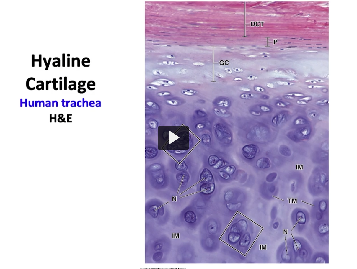 <p>Observe this slide. Here we have a slice of a tracheal ring. The rings of the trachea are pure hyaline cartilage. This is hyaline cartilage (pointing to the bottom purple). </p><p>The reddish--pink at the top if perichondrium, where we have the chondrogenic layer and the fibrous layer. These developing small cells here are chondroblasts (where the GC is located). Over here (going to the purple) with the mature cartilage we have chondrocytes in their lacunae. </p><p>Notice the dark area I mentioned previously that surrounds the chondrocytes known as the territorial matrix, and between them the clear areas which are more acidophilic (the lighter purple between the dark purple) are the interterritorial matrix portion. </p><p>Where are the isogenous groups? We have two isogenous groups, demarcated by the squares and they are a group of chondrocytes which were the products of cellular division, interstitial growth. </p>