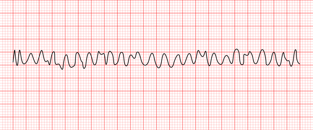 <p>Guess the Rhythm></p>