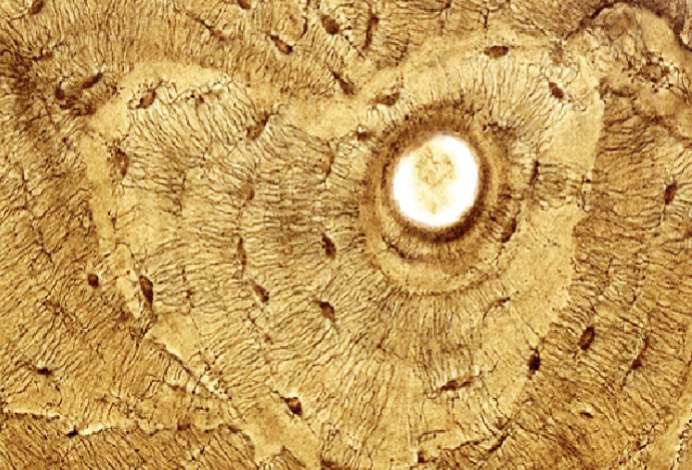 <p>What are the rings in this histology slide of a bone?</p>