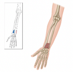 <p>What is the muscle highlighted?</p>