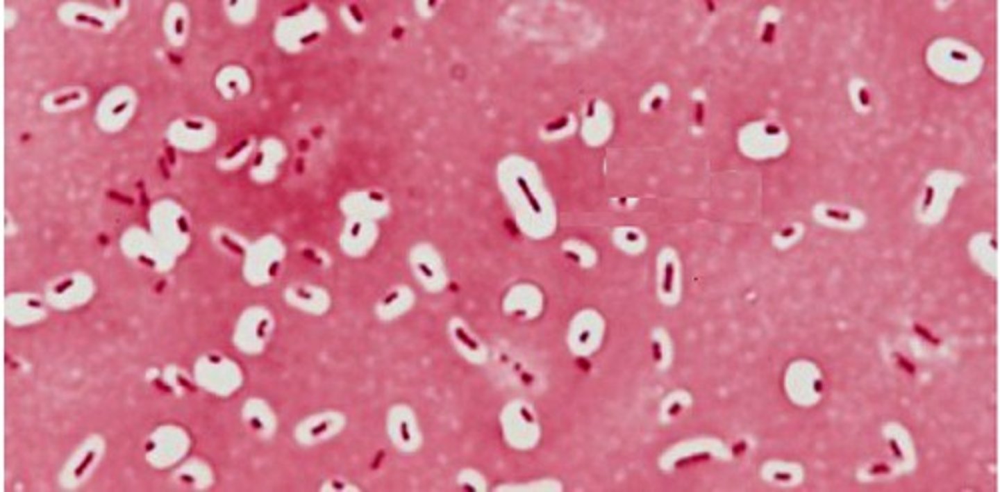 <p>negative</p>