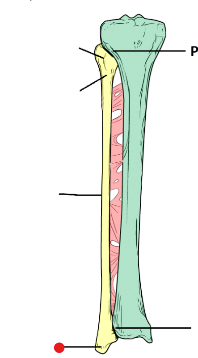 <p>Identify the structure pinned</p>