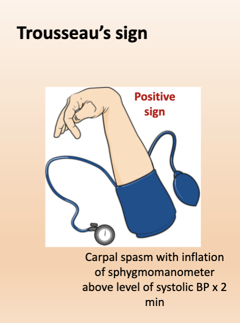 <p>a sign of Hypomagnesemia OR Hypocalcemia</p><p>= carpal spasm w/ inflation of BP cuff above lvl of systolic BP x2 min</p>