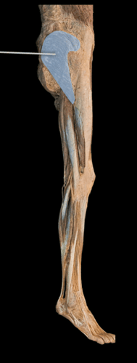 <p>What muscle is this?</p>