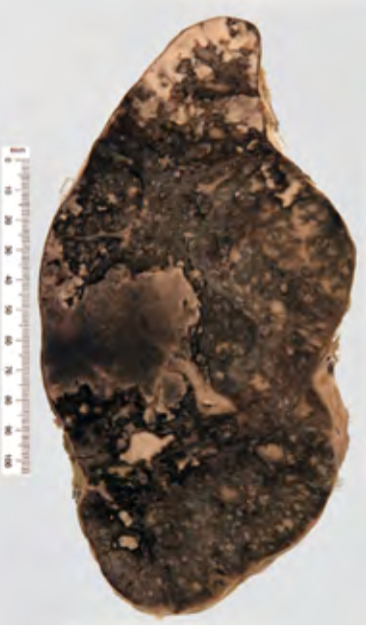 <p>Identify the POT</p>