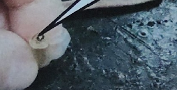 <p>What is this on the earthworm segment</p>