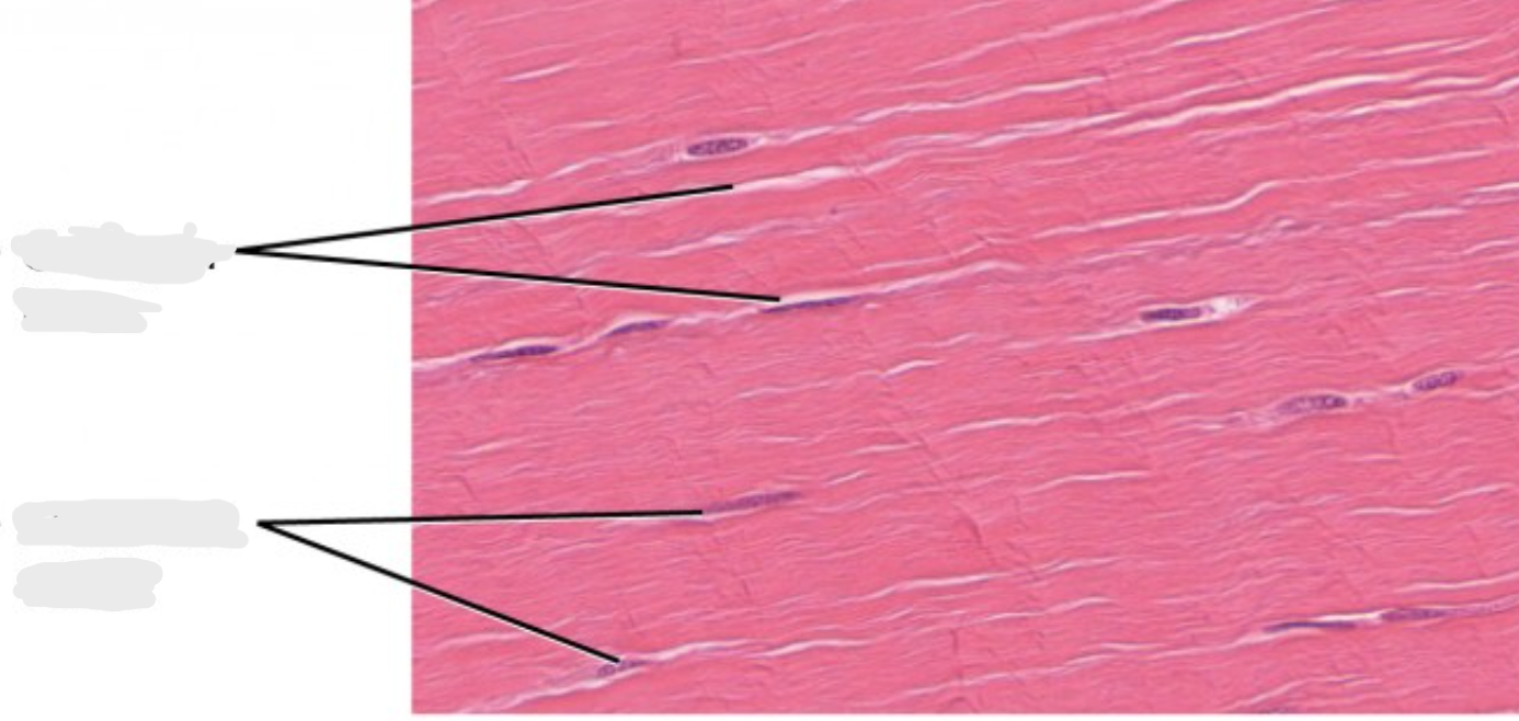 <p>what type of CT is this and what are the lines pointing to?</p>