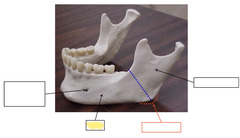 <p>Mandible</p>