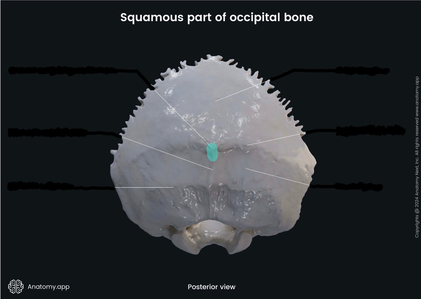 <p>What is the highlighted bony landmark</p>