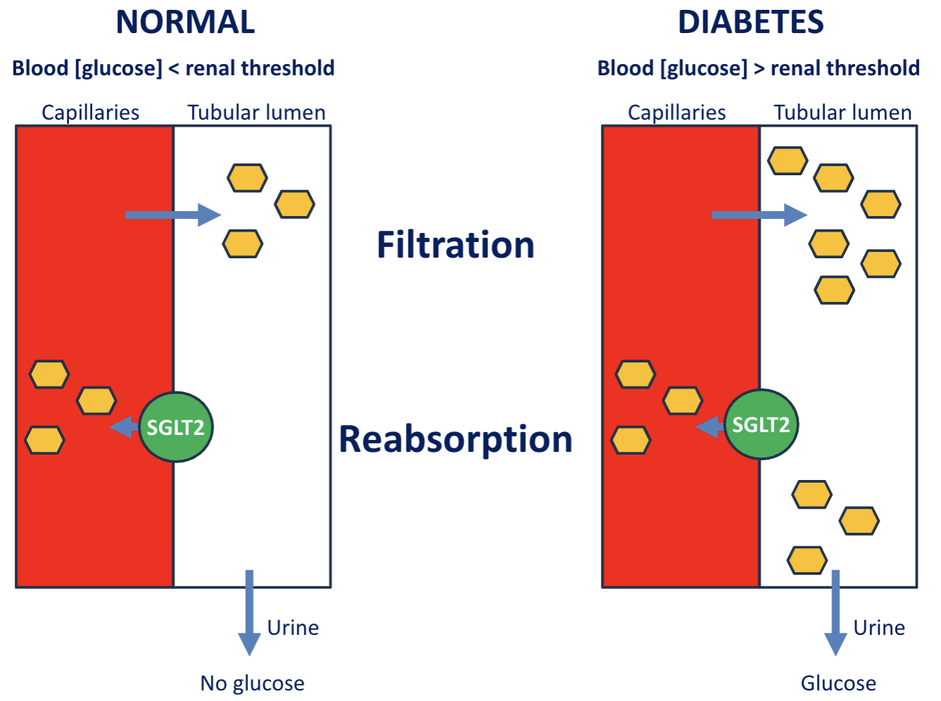 <ol><li><p>Not all glucose are reabsorbed by the SGLT in kidney</p></li><li><p>Glucose in lumen increases drawing water out </p></li><li><p>High volume of urine</p></li></ol><p></p>