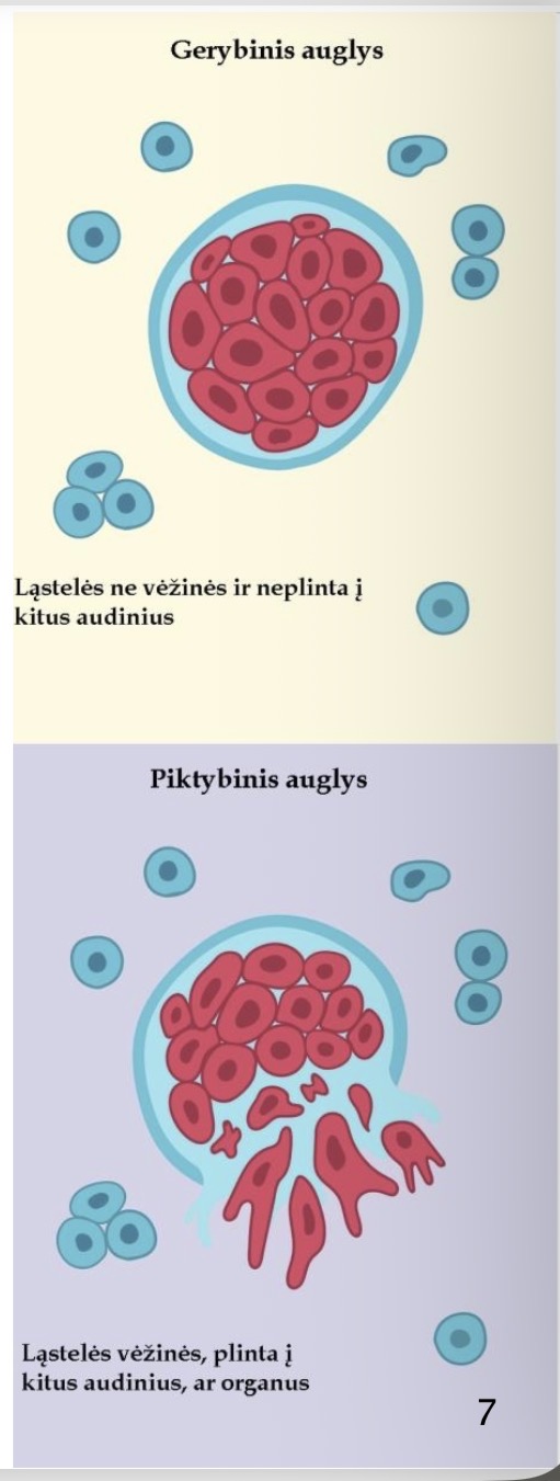 <p><span>• Ląstelės skverbiasi vis gilyn į organo, iš kurio išsivystė, audinį, neišplisdami į gretimus įauga į gretimus organus. bei tolimesnius organus.</span></p><p><span>• Didėdami gali spausti</span></p><p><span>• Ląstelės labai skiriasi nuo sveikojo audinio ląstelių, iš kurių</span></p><p><span>šalimais esantį organą. išsivystė: jos nesubrendusios, nevisiškai diferencijuotos.</span></p><p><span>• Dažniausiai sėkmingai</span></p><p><span>• Ląstelės turi savybę atskilti nuo naviko ir limfos ar kraujo keliu pašalinami operacijos išplisti į sritinius limfmazgius, kitus kūno organus neretai būdu, pakartotinai atauga atokius nuo pirminio židinio. retai.</span></p><p><span>• Ląstelės mažai kuo</span></p><p><span>• Pasiekusios naują vietą, šios ląstelės ten „prigyja“, dauginasi, skiriasi nuo tų, iš kurių susidaro nauji dukteriniai navikai, vadinami metastazėmis. išsivystė, jos tik neįprastai išsidėsčiusios.</span></p><p><span>• Metastazės ypač sunkina ligos eigą.</span></p>
