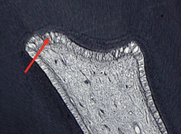 <p>ID the black fibers at the point</p>