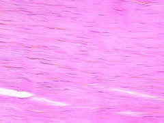 <p>dense regular</p>