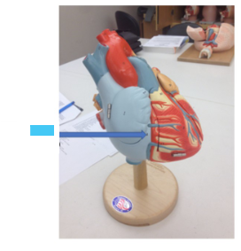 <p>What is the blue arrow?</p>