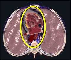 <p>Chamber between 2 pleural cavities where heart, great vessels, trachea, thymus and esophagus are located</p>