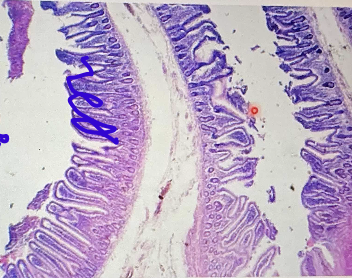 <p>a.) What is this organ?</p><p>b.) What is the parenchyma of the cell?</p><p>c.) How many nucleus?</p><p>d.) What is the stroma?</p><p>e.) What is the arrangement of the cell?</p><p>f.) location of the nucleus?</p><p>g.) Shape?</p>