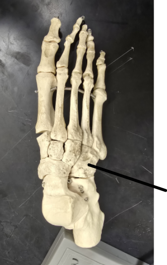 <p>Name Tarsal Bone</p>