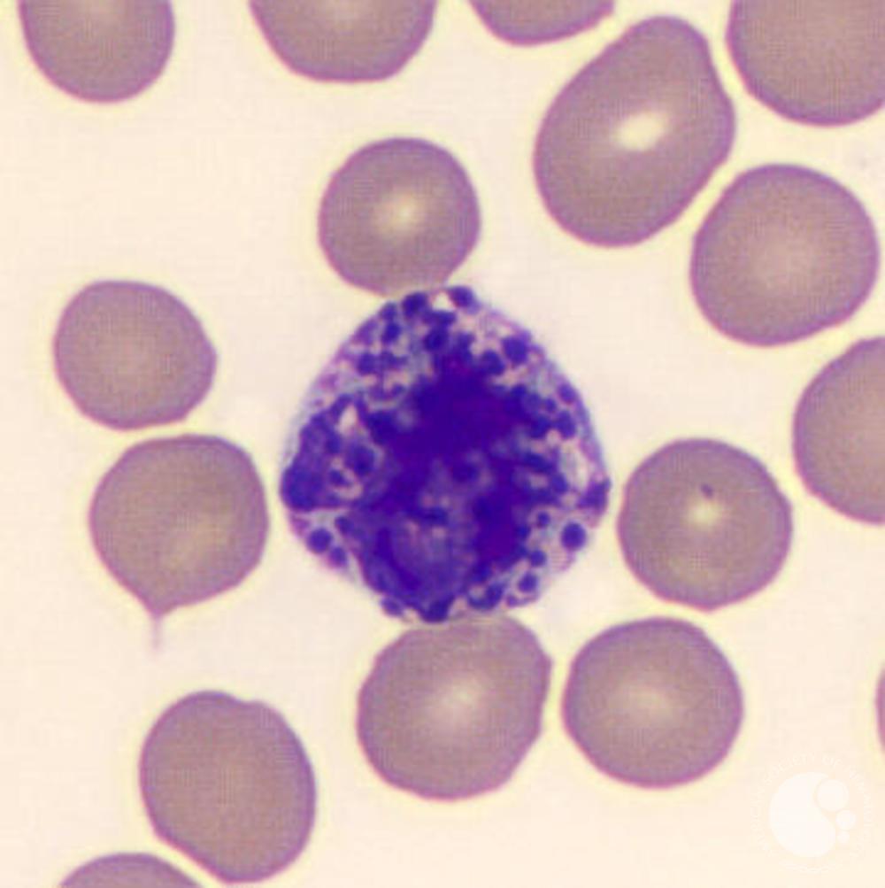 <p>> 1 % </p><ul><li><p>granules release histamine and heparin </p><ul><li><p>Histamine dilates blood vessels </p></li><li><p>heparin prevents abnormal blood clotting </p></li></ul></li></ul><p></p>