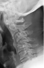 <p>What is the diagnosis?</p>