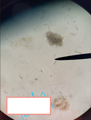 <p>• mitosomes </p><p>• ANAEROBIC PATHWAYS</p><p>• parasitic</p><p>• two equal-sized nuclei and multiple flagella</p><p>• Giardia intestinalis - feces water "beaver fever"</p>