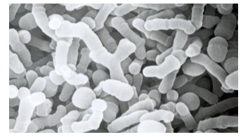 <p></p><p><span style="color: rgb(255, 255, 255);">FEATURES<br>• Gram-positive bacterium<br>• Beneficial bacterium<br>• Obligate anaerobic<br>• Yogurt<br>• Y-shaped cells</span></p><p></p>