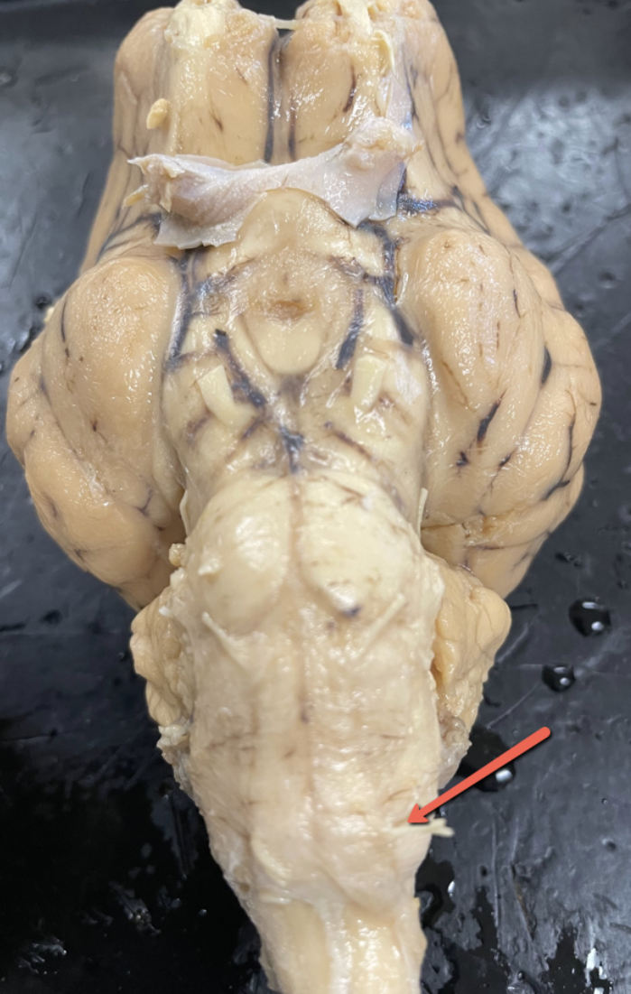 <p><span>Identify the cranial nerve indicated by the pointer.</span></p>