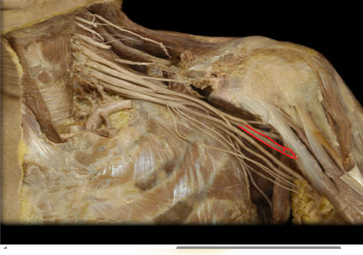 <p>What nerve is this </p>