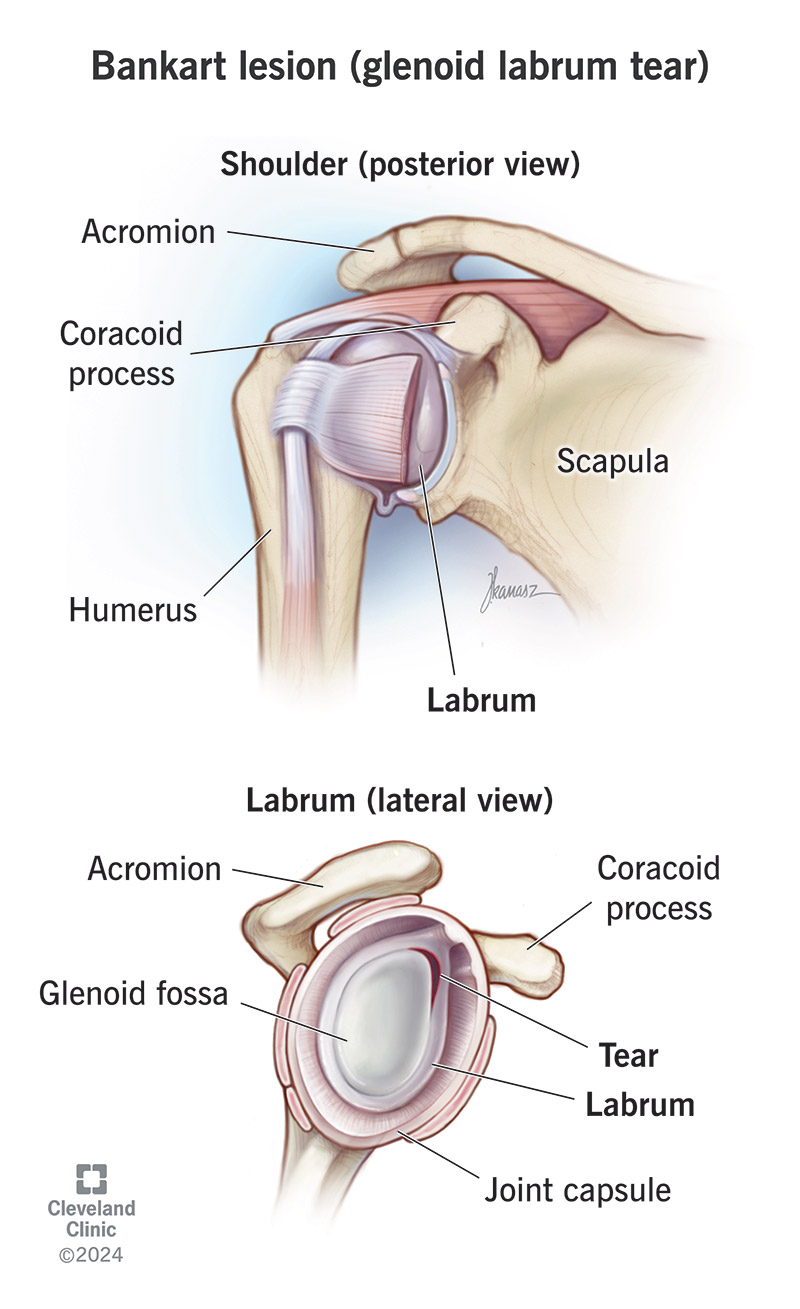 <p>A structure that deepens the glenoid cavity to assist in stabilizing the glenohumeral joint.</p>
