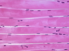 <p>What is this tissue shown?</p>