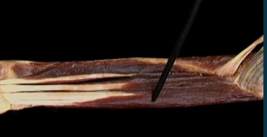 <p>Diep onderarm, anterior zicht</p>