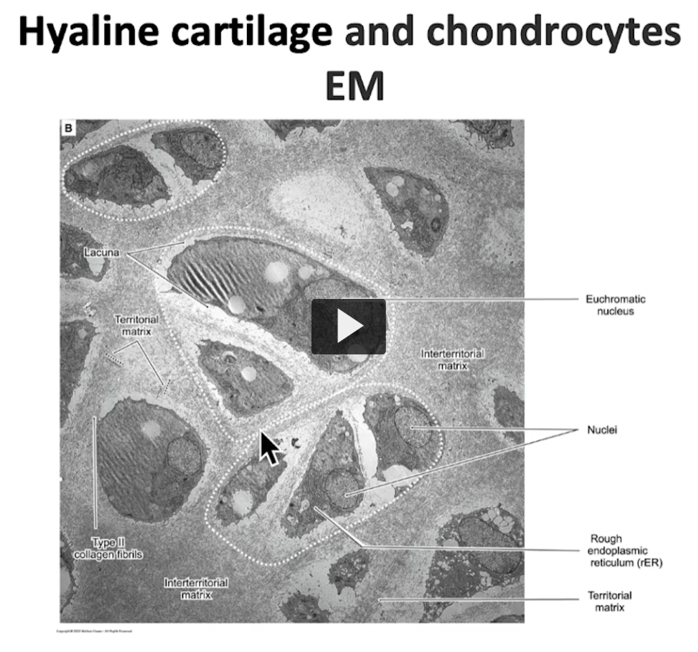 <p>Let us see in this last slide where you will see a group of chondrocytes in their lacunae. </p><p>See the territorial matrix, the one that will surround the group of chondrocytes, forming an isogenous group. </p>