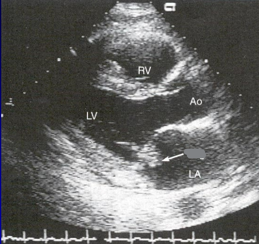 term image