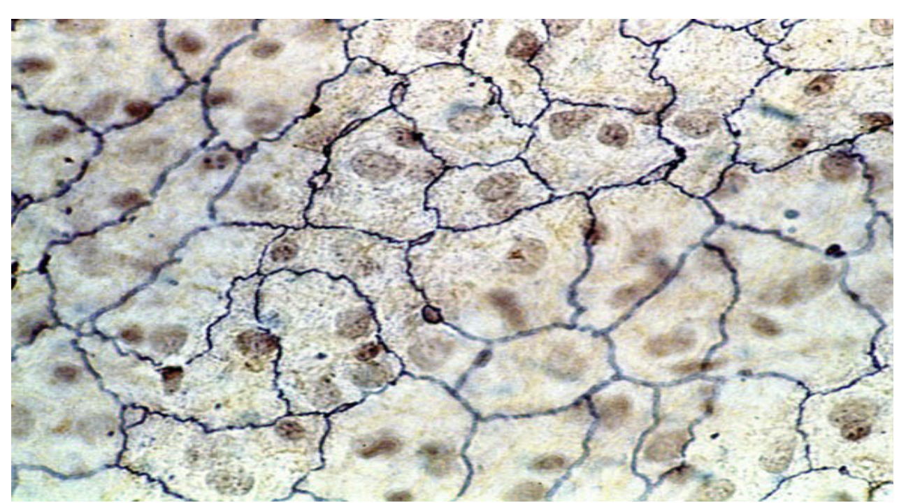 <p>What is this Tissue? and where is it found ?</p>